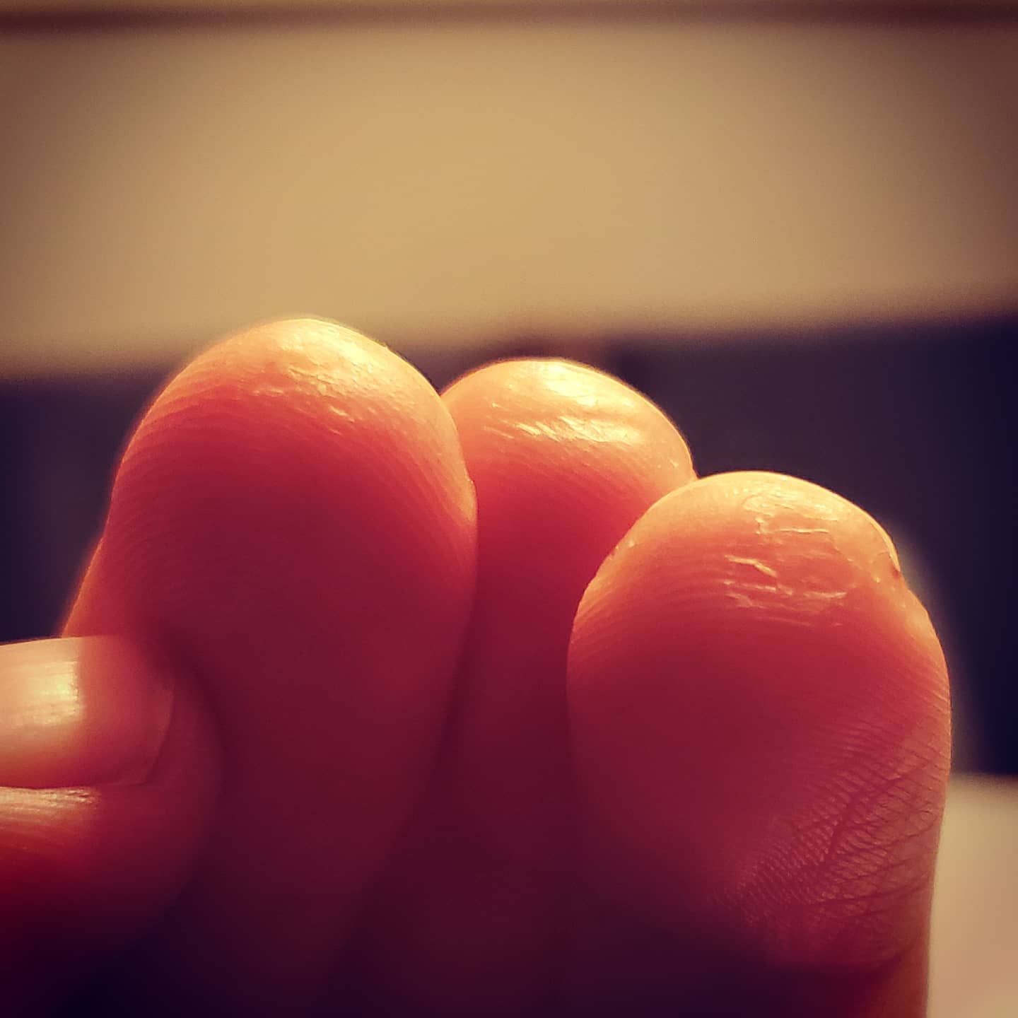 #guitar #fingers #calluses